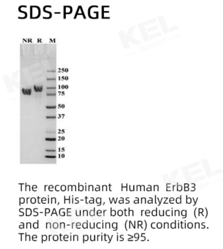 Recombinant Human ErbB3 (HER3)