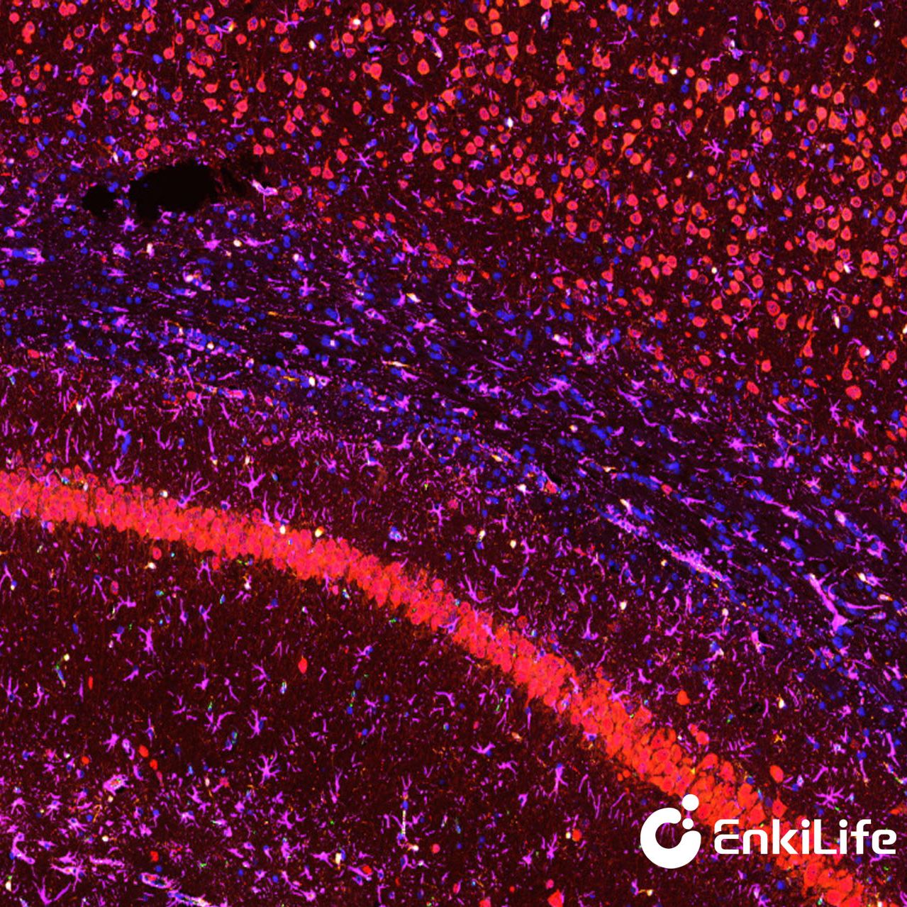 TSA四标五色多重荧光染色试剂盒（mIHC）