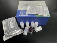 人抗狂犬病毒RV抗体 elisa检测试剂盒价格