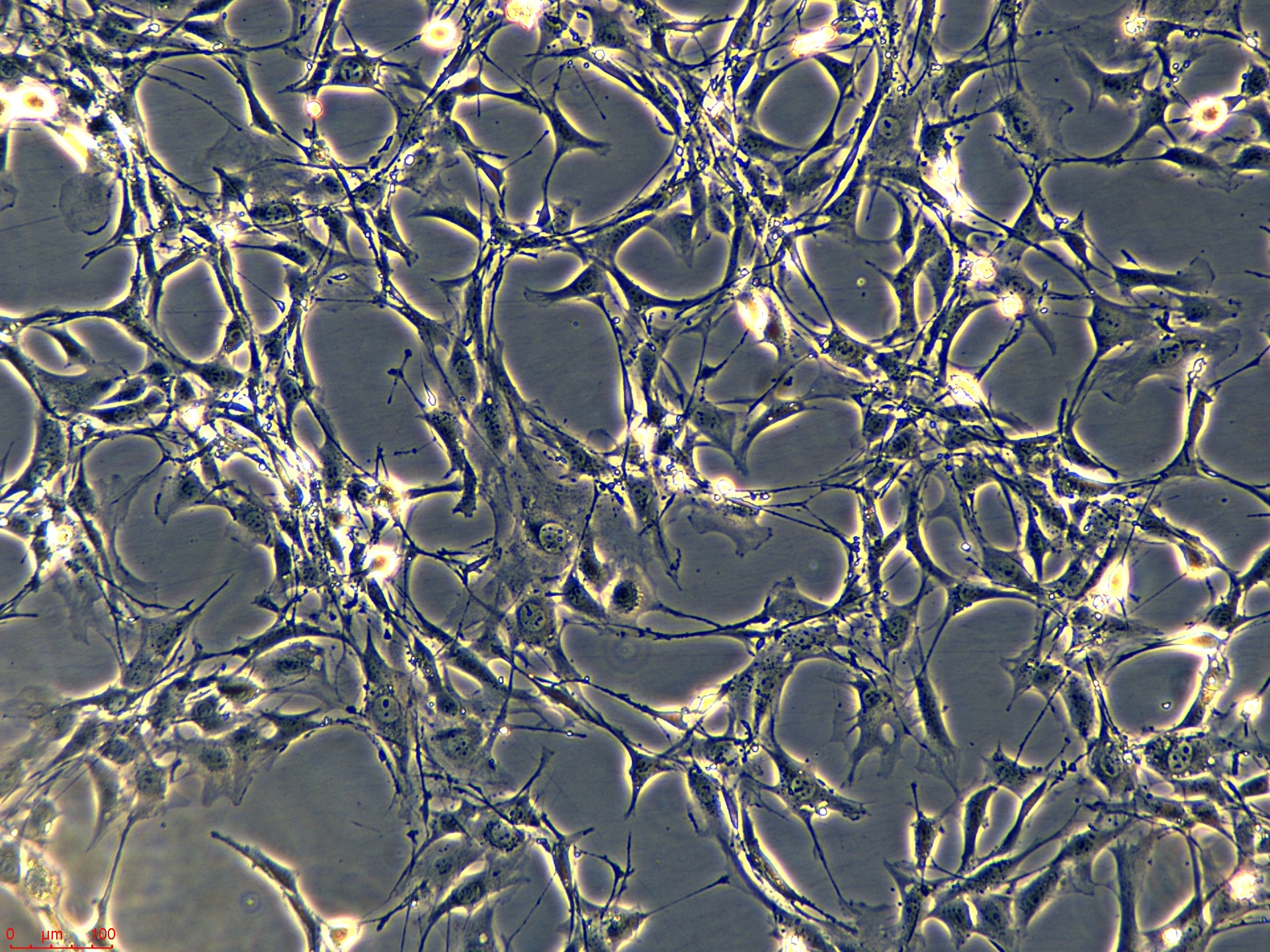 Project_C3H-10T1-2 CLONE 8_ch00.jpg