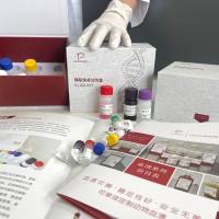 人（Human）重肽铁蛋白(FTH)ELISA检测试剂盒