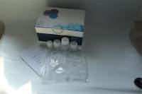 腮腺炎病毒PCR检测试剂盒