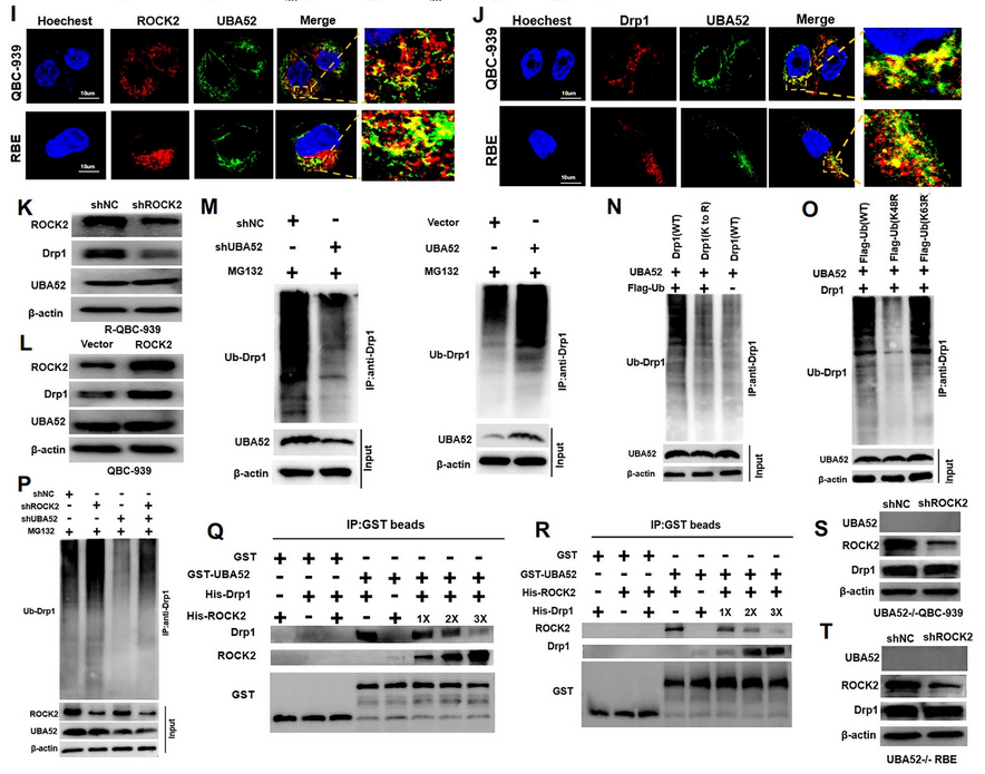 AtaGenix蛋白定制服务助力研究CCA细胞对Pemigatinib的耐药机制