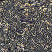 浙江美森-人皮肤成纤维细胞HSF现货