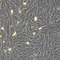 浙江美森-人原代外根鞘细胞