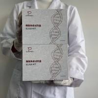 人（Human）糖原合成酶激酶3β(GSK3β)ELISA检测试剂盒 