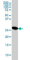 MTAP monoclonal antibody (M01), clone 2G4