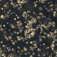 浙江美森-脑神经细胞瘤细胞CHP-212现货