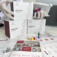 人(Human)肥胖抑制素(OB)ELISA检测试剂盒