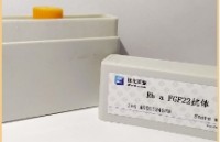 重组猪蓝耳病病毒N蛋白