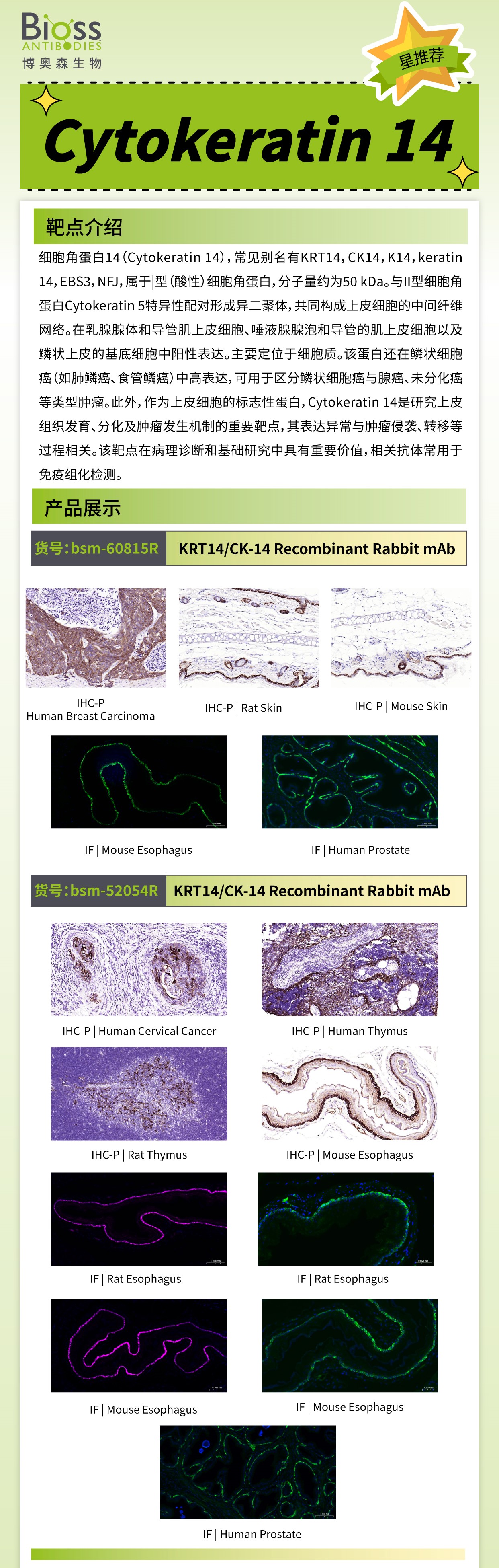 Bioss 星推荐 | Cytokeratin 14 抗体