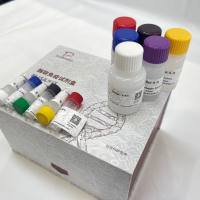 人（Human）血小板膜糖蛋白VI(GP6)ELISA检测试剂盒 