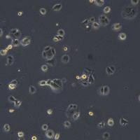 浙江美森-人非小细胞肺癌细胞NCI-H2126现货