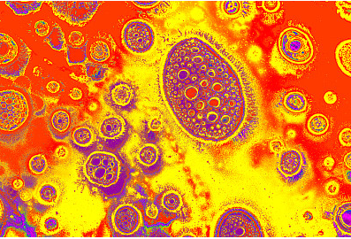 支原体污染是细胞培养中常见困扰