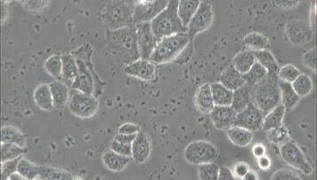 从避坑到精通—攻克细胞污染及培养难题