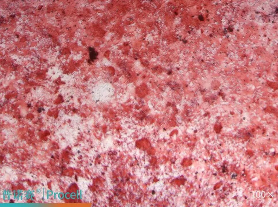 大鼠骨髓间充质干细胞成骨分化鉴定结果