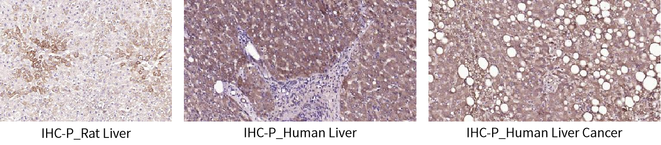 Bioss爆品推荐 | 血管“生锈”的元凶是谁?ox-LDL高效研究工具助您一探究竟