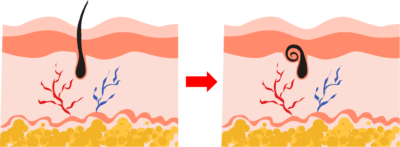 一文讲清！免疫缺陷小鼠选择黄金指南