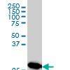 MTAP monoclonal antibody (M01), clone 2G4