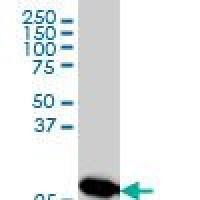 MTAP monoclonal antibody (M01), clone 2G4
