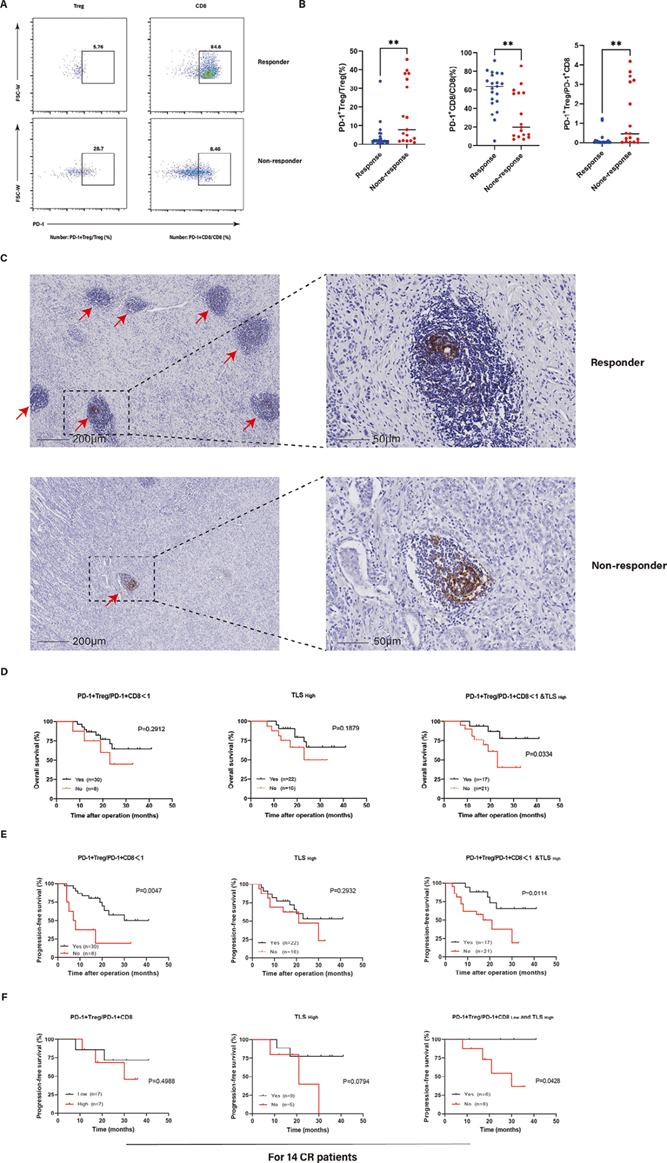 双指标联动| PD-1+Treg/PD-1+CD8 比值与 三级淋巴结构TLS 在晚期胃癌术前治疗中的预后及响应关联