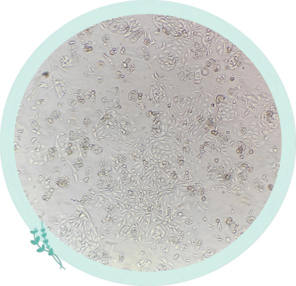 肾近端小管功能的核心执行者——Megalin蛋白
