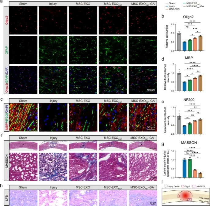 IF:12+，双肽修饰+药物负载+铁死亡，这篇脊髓损伤研究的外泌体设计，手把手教你做创新！