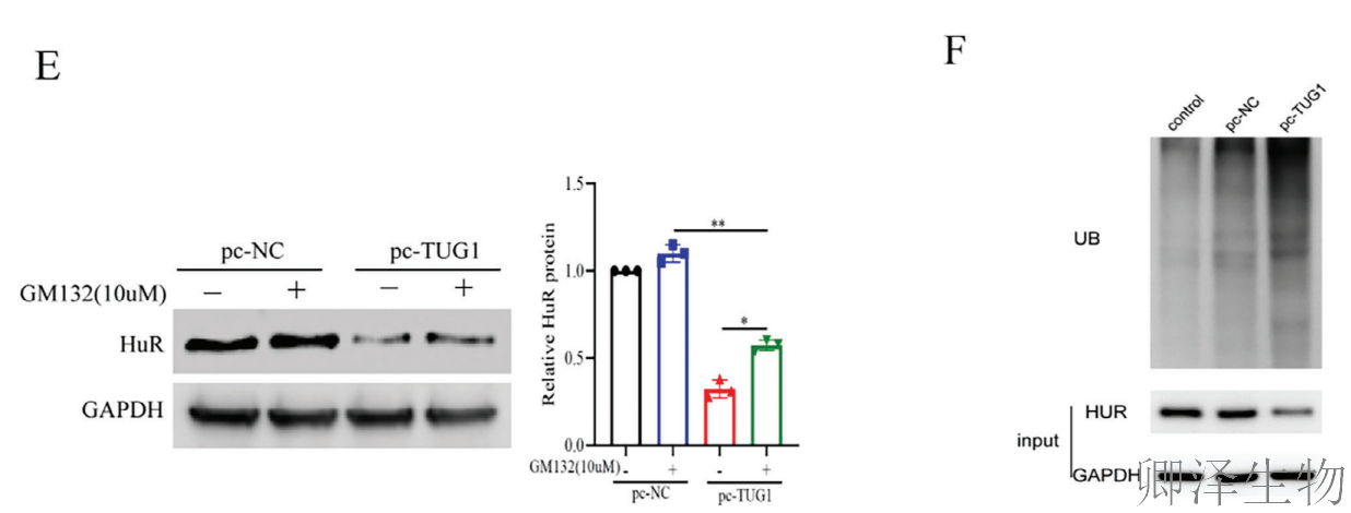 【分子间博弈】 | Polysome技术协助破解脑卒中血管新生调控新机制！