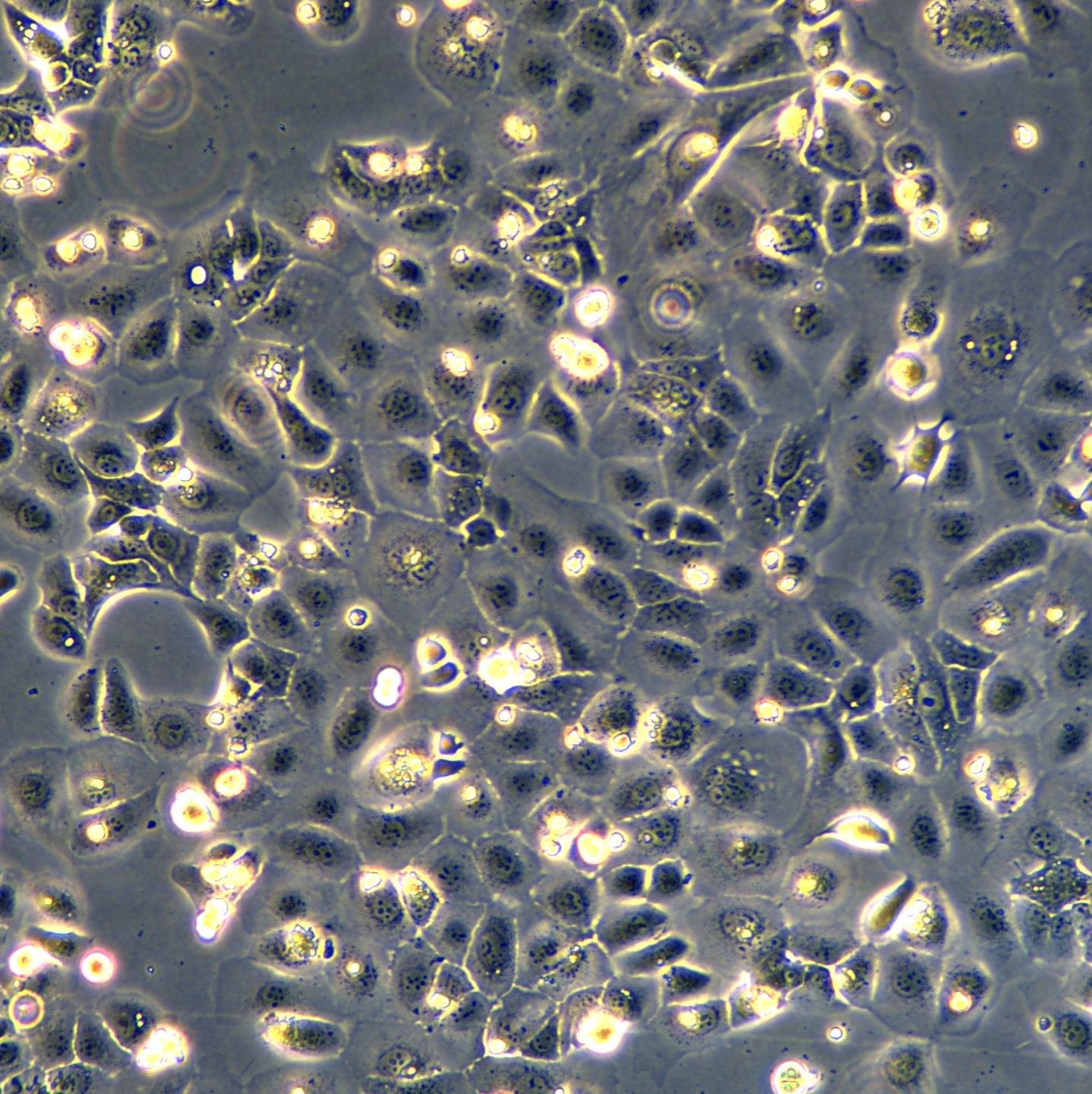 浙江美森-人肺癌腺癌细胞 LC-2/ad