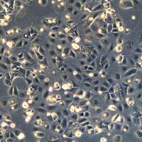 浙江美森-人肺癌腺癌细胞 LC-2/ad