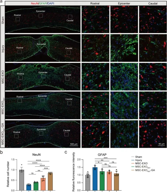 多肽修饰外泌体