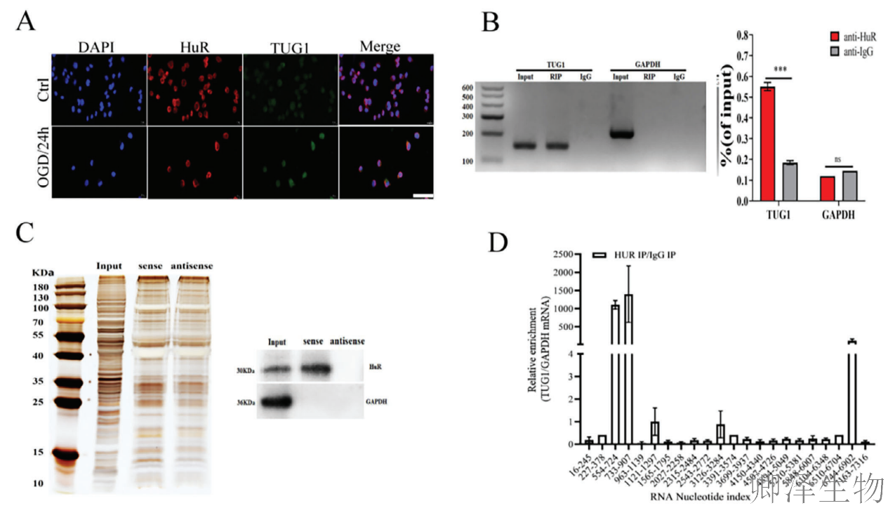 【分子间博弈】 | Polysome技术协助破解脑卒中血管新生调控新机制！