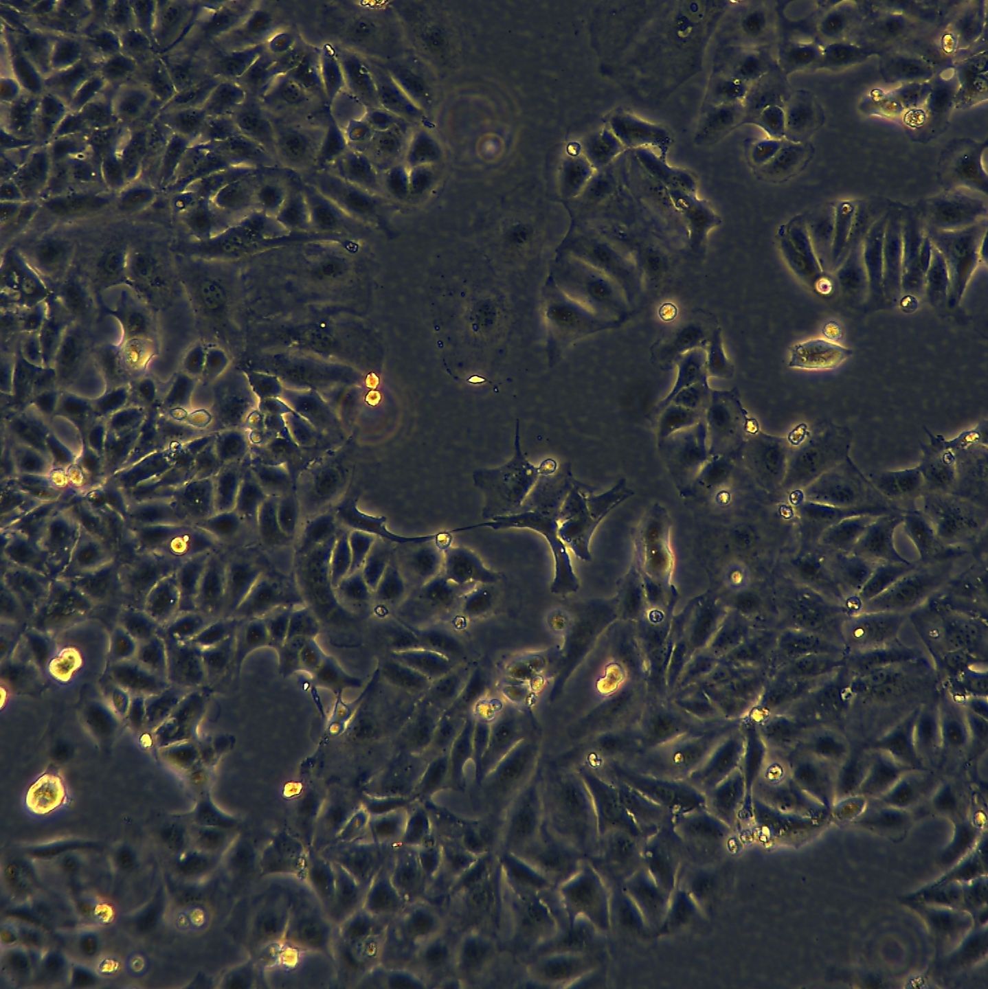 浙江美森-卵巢癌细胞 OAW42