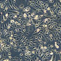 浙江美森-卵巢内膜样癌COV362