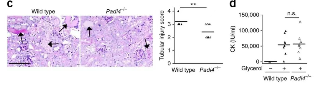 METs在横纹肌溶解症引发AKI中的作用.png METs在横纹肌溶解症引发AKI中的作用.png