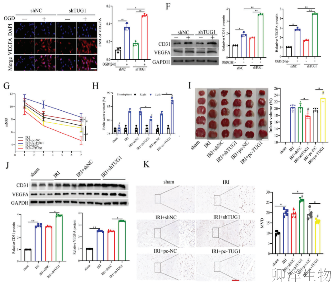 【分子间博弈】 | Polysome技术协助破解脑卒中血管新生调控新机制！