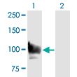 STAT6 monoclonal antibody (M01), clone 6C10