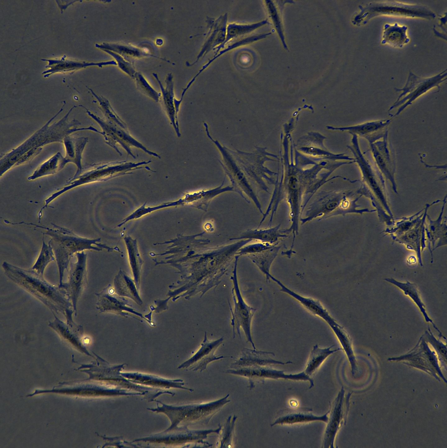 浙江美森-人结直肠肿瘤成纤维细胞CAF05