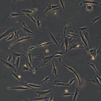 浙江美森-人结直肠肿瘤成纤维细胞CAF05