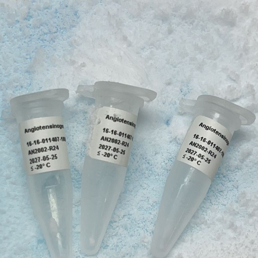 Lipoprotein a, Lp(a)  12-16-121601