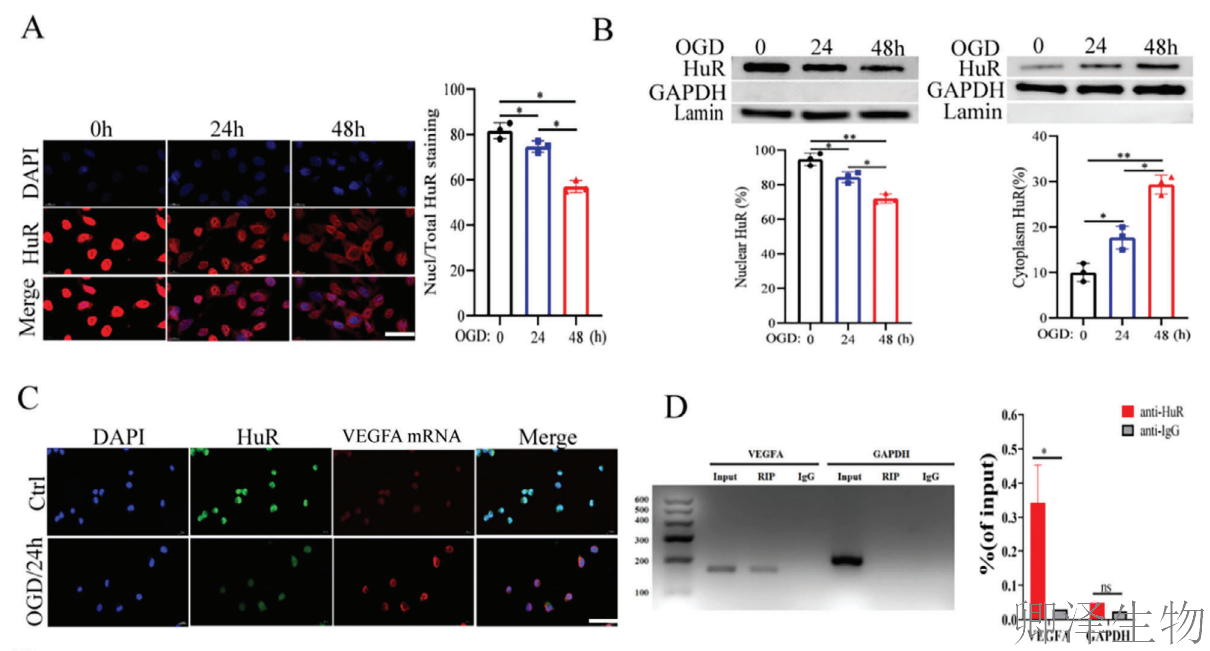 【分子间博弈】 | Polysome技术协助破解脑卒中血管新生调控新机制！