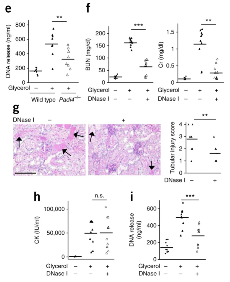 METs在横纹肌溶解症引发AKI中的作用 METs在横纹肌溶解症引发AKI中的作用