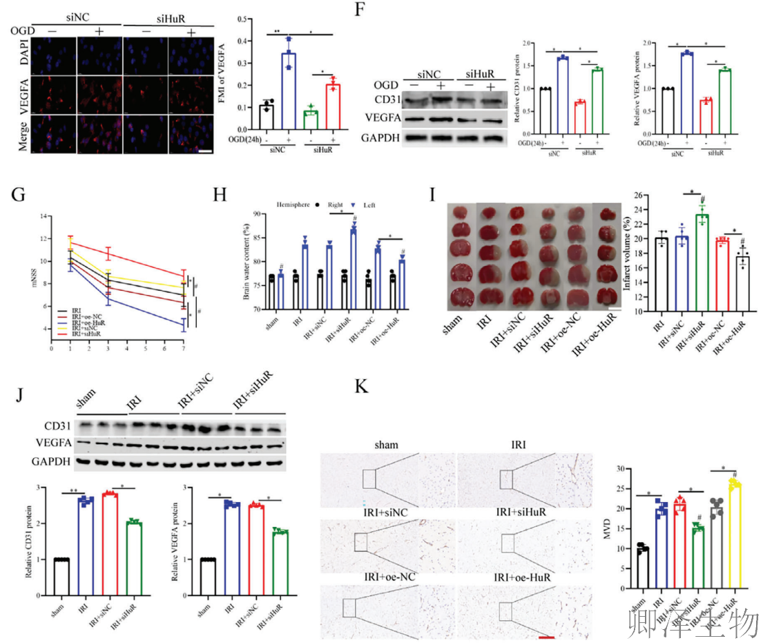 【分子间博弈】 | Polysome技术协助破解脑卒中血管新生调控新机制！