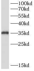 TK2 antibody|TK2抗体