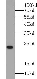 Pre-IL18 antibody|Pre-IL18抗体 F