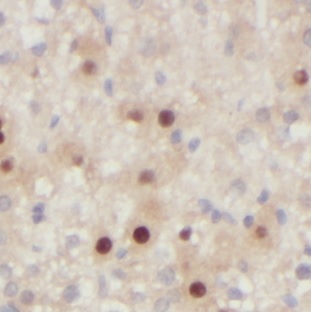 FUCA1 antibody|FUCA1抗体