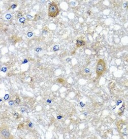 ETFA antibody|ETFA抗体