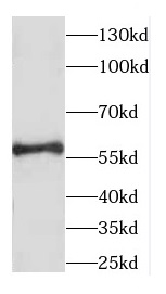 CCDC65 antibody|CCDC65抗体