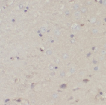 PDHA1 antibody|PDHA1抗体 FNab062