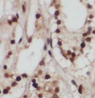 GPS1 antibody|GPS1抗体